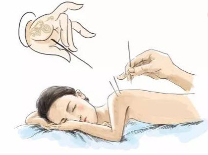 成都市針灸推拿職業(yè)學院怎么樣?針灸推拿專業(yè)職業(yè)