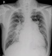 醫(yī)學影像技術未來的發(fā)展