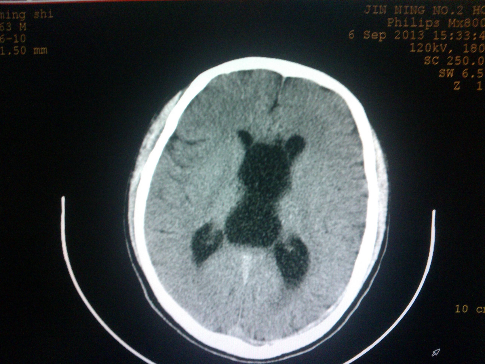 醫(yī)學影像學練習題