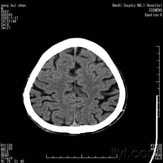 醫(yī)學影像學練習題