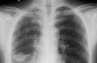 醫(yī)學(xué)影像學(xué)中常用的概念