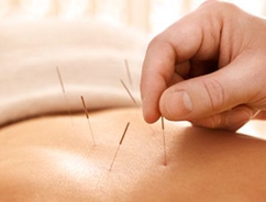 中醫(yī)針灸法的特點【全】