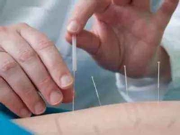 針灸推拿學(xué)就業(yè)前景